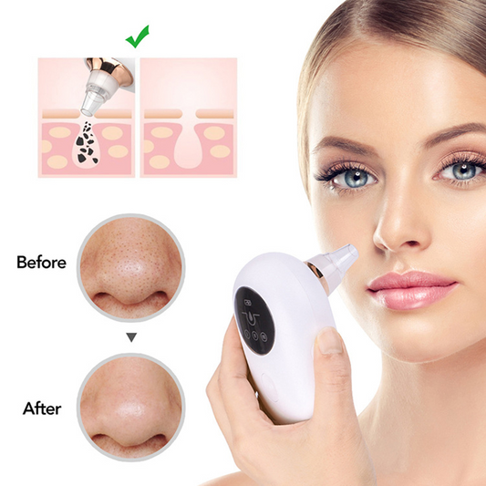 Cleaner Vacuum Blackhead Remover